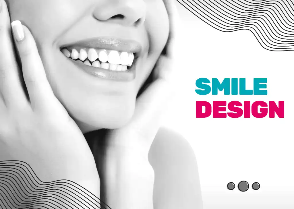 Smile design – What is it?